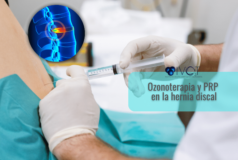 ozonoterapia y PRP en la hernia discal